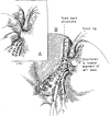 FIG. 6
