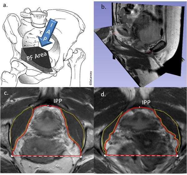 Figure 1: