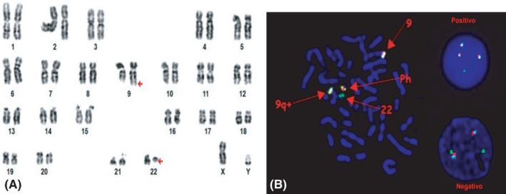 FIGURE 1