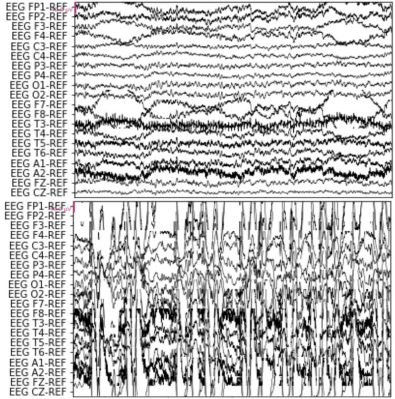 Fig. 2