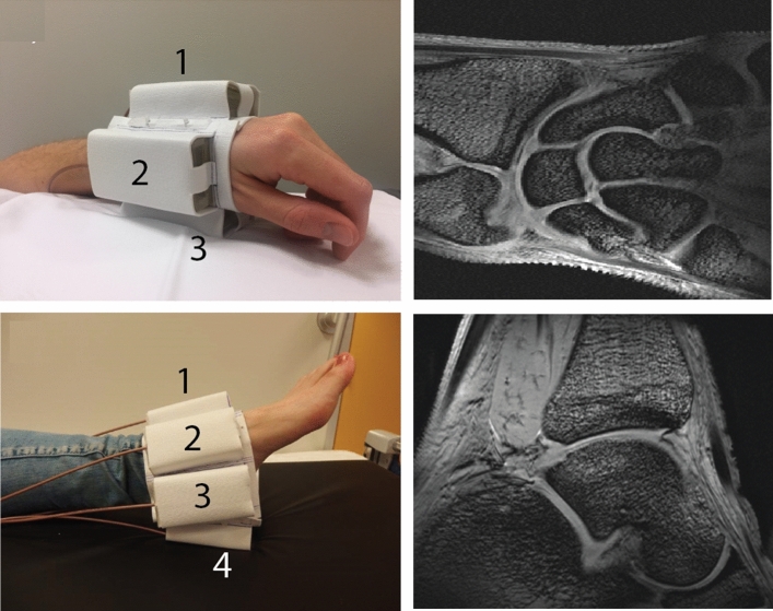 Fig. 22