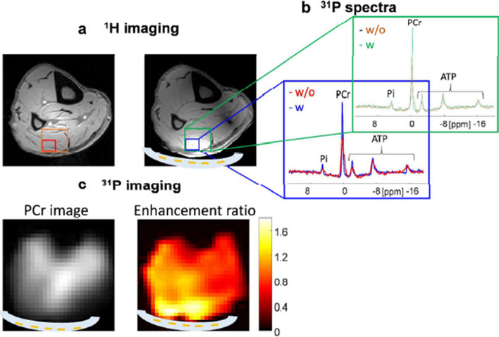 Fig. 17