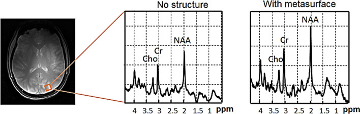 Fig. 15