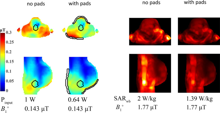 Fig. 11