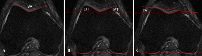 Fig. 2A–C