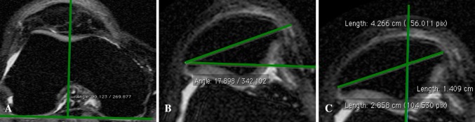 Fig. 3A–C