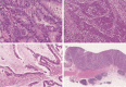 Fig. 23