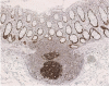 Fig. 25