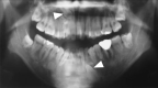 Fig. 16