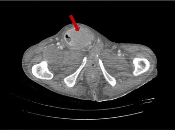 Fig. 2