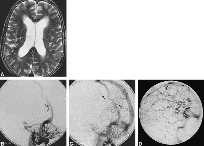 fig 2.