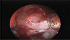 Fig. 11