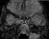 Fig. 12