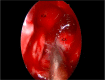 Fig. 13