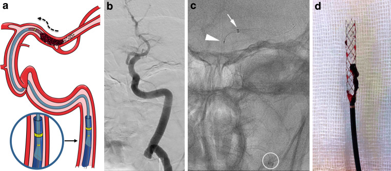 Fig. 1