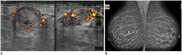 Fig. 12