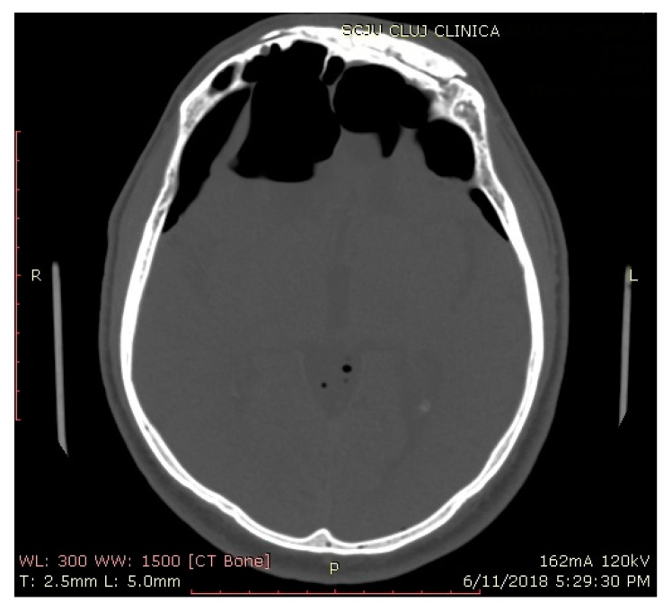 Figure 5