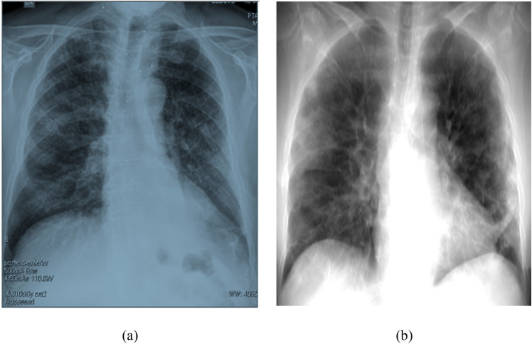 Fig. 18