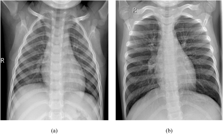 Fig. 19