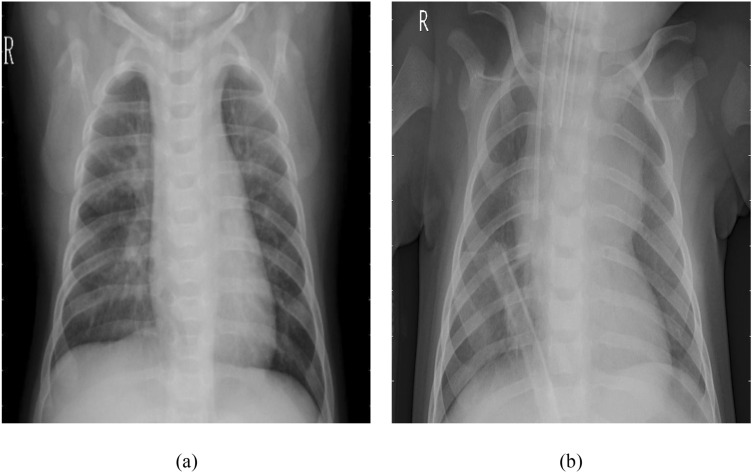 Fig. 20