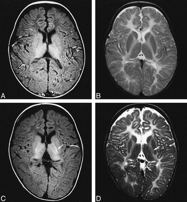 fig 2.