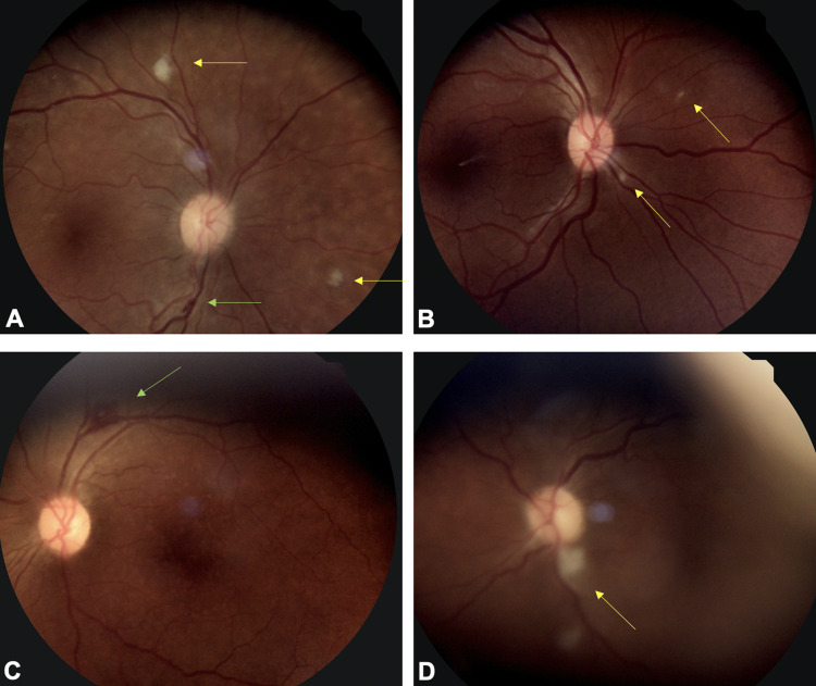 Fig 1