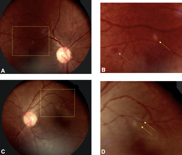 Fig 2