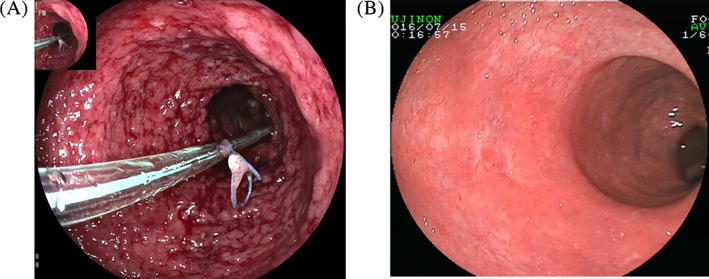 FIGURE 1