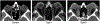 Figure 1 -