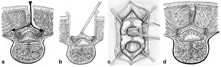 Fig. 1. a