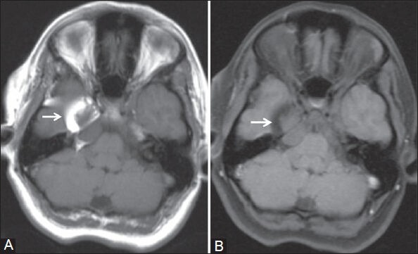 Figure 5 (A,B)