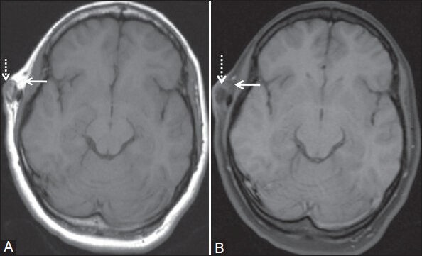 Figure 2 (A, B)