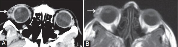 Figure 4 (A, B)