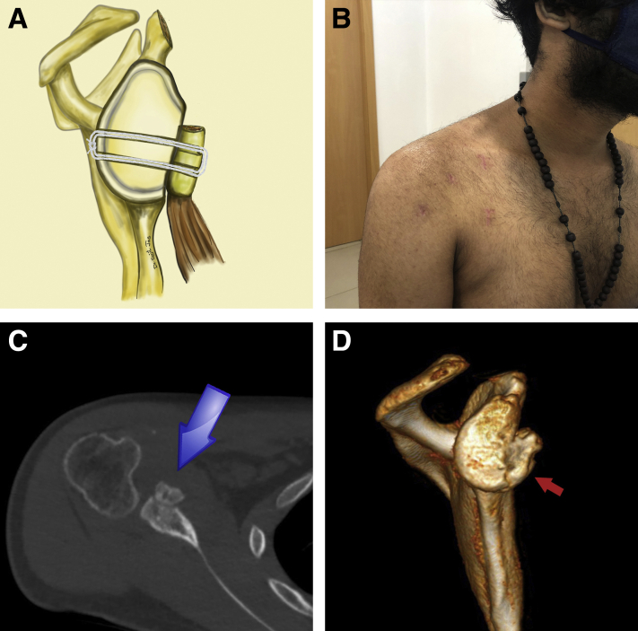 Fig 11