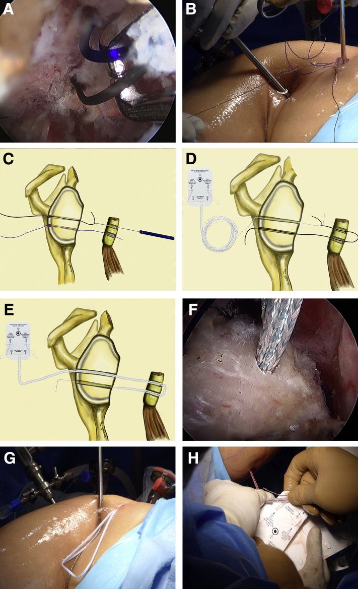 Fig 8