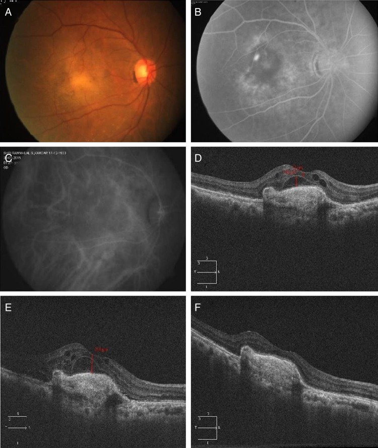 Figure 2