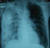 Figure 2)