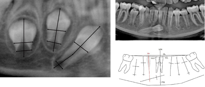 Fig. 2