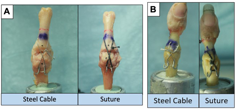 Figure 2