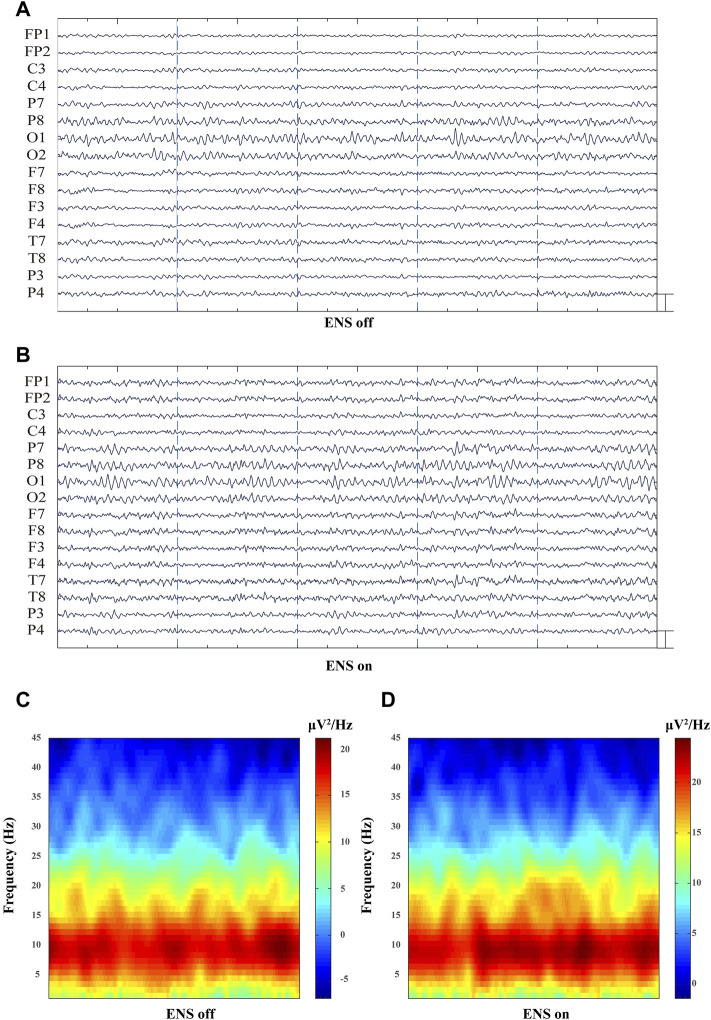 FIGURE 4