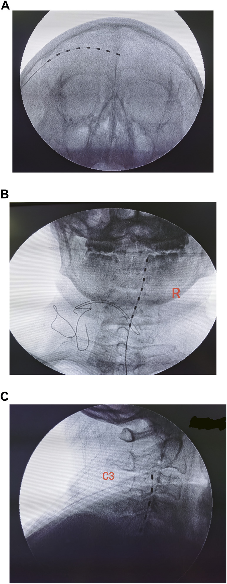 FIGURE 1