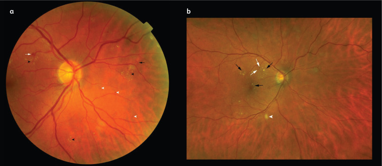 Fig 1.