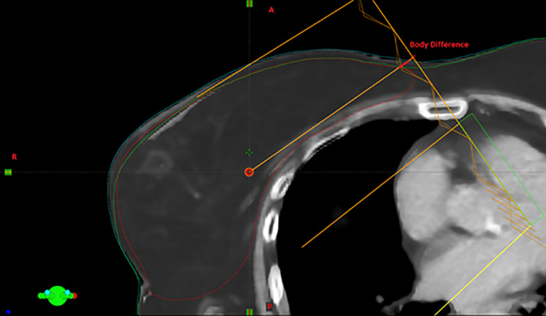 Figure 1