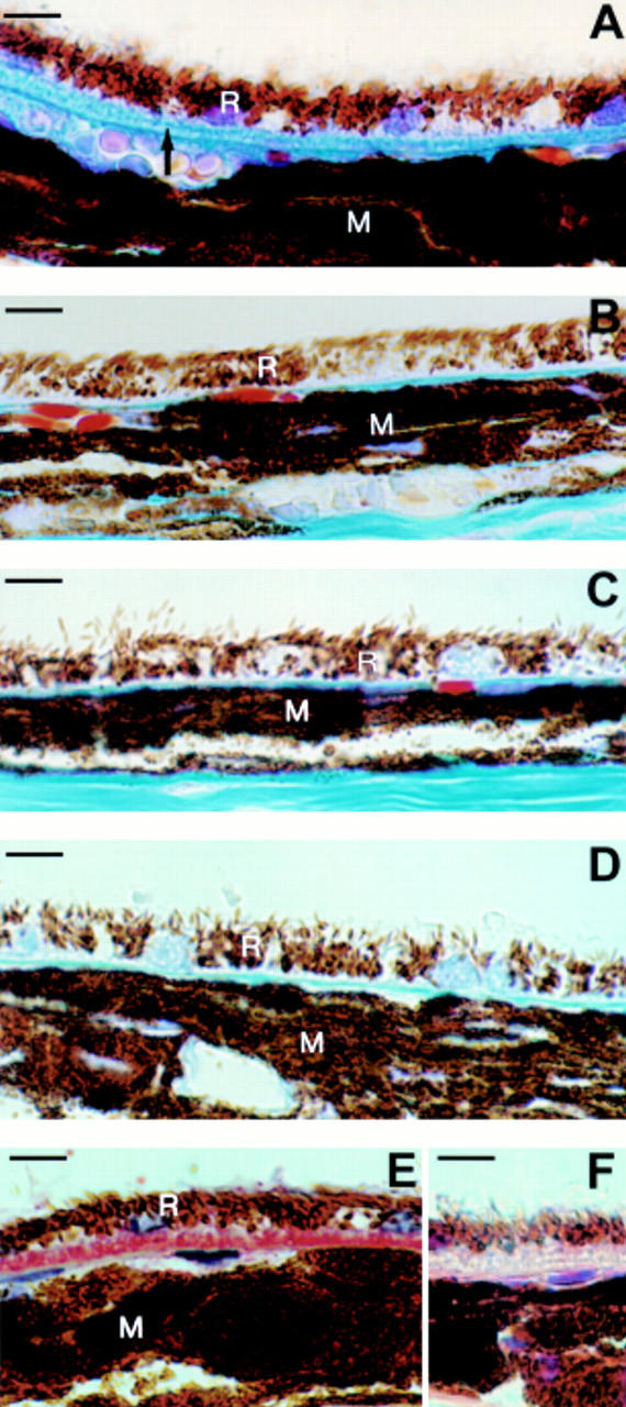 Figure 1  