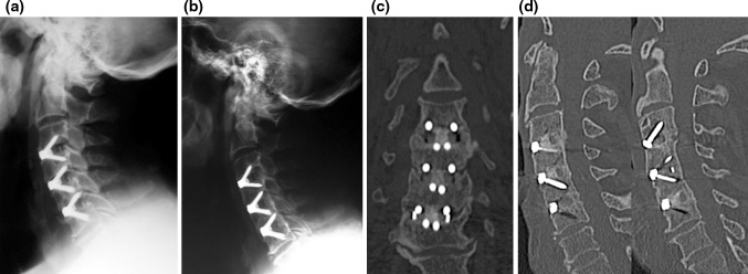 Fig. 10