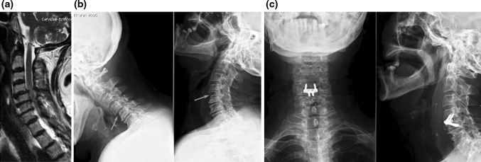 Fig. 1