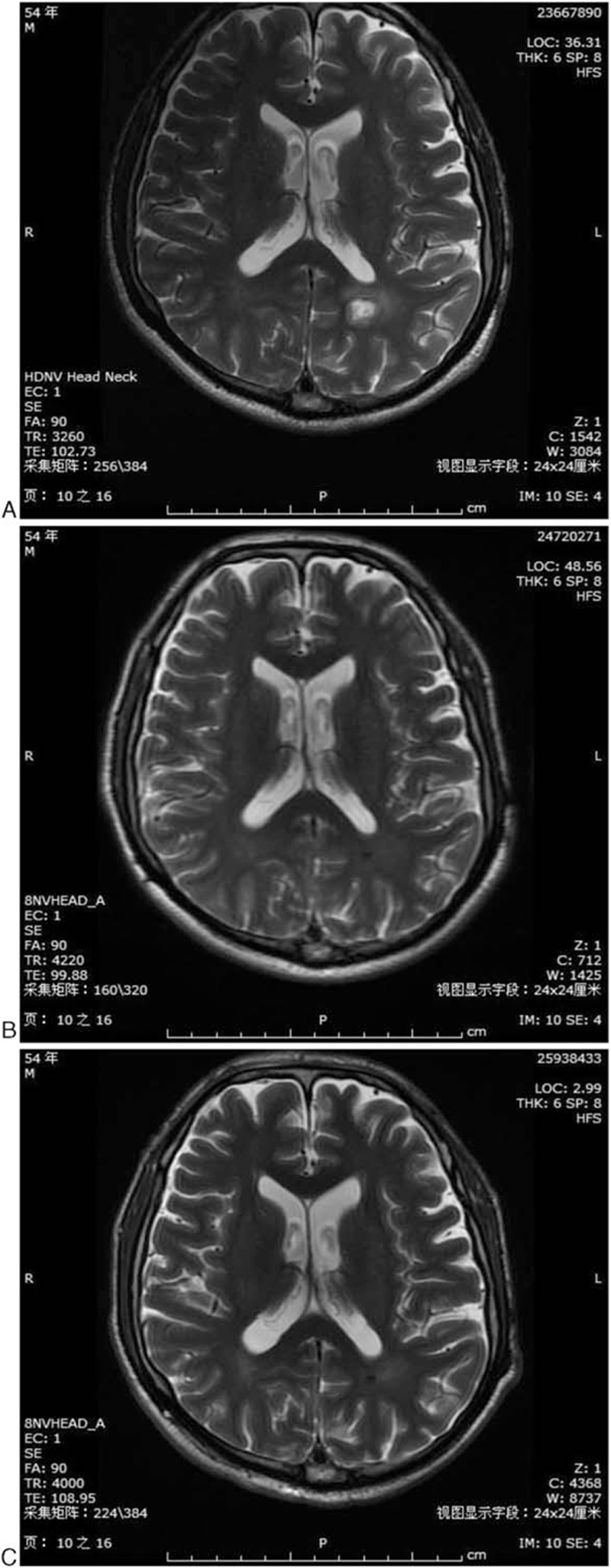 Figure 2