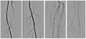 Figure 21