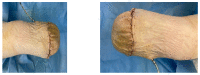 Figure 22