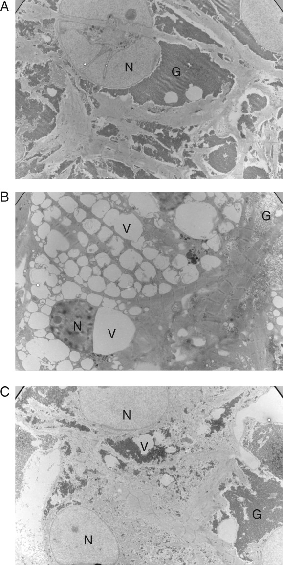 EJHF-1154-FIG-0006-b